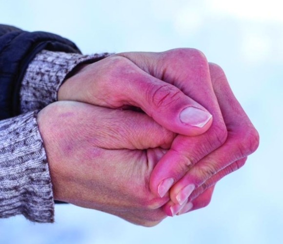 Chăm sóc da tay vào mùa lạnh khô