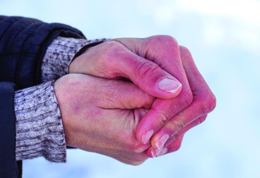 Chăm sóc da tay vào mùa lạnh khô